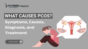 Polycystic Ovary Syndrome Treatment