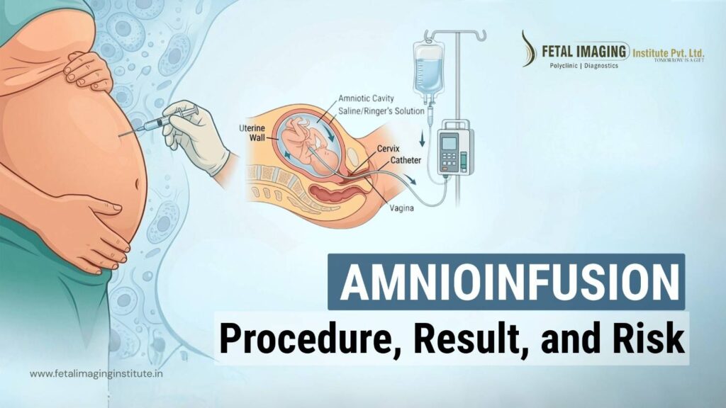 Amnioinfusion Procedure: What to Expect, Benefits & Potential Risks